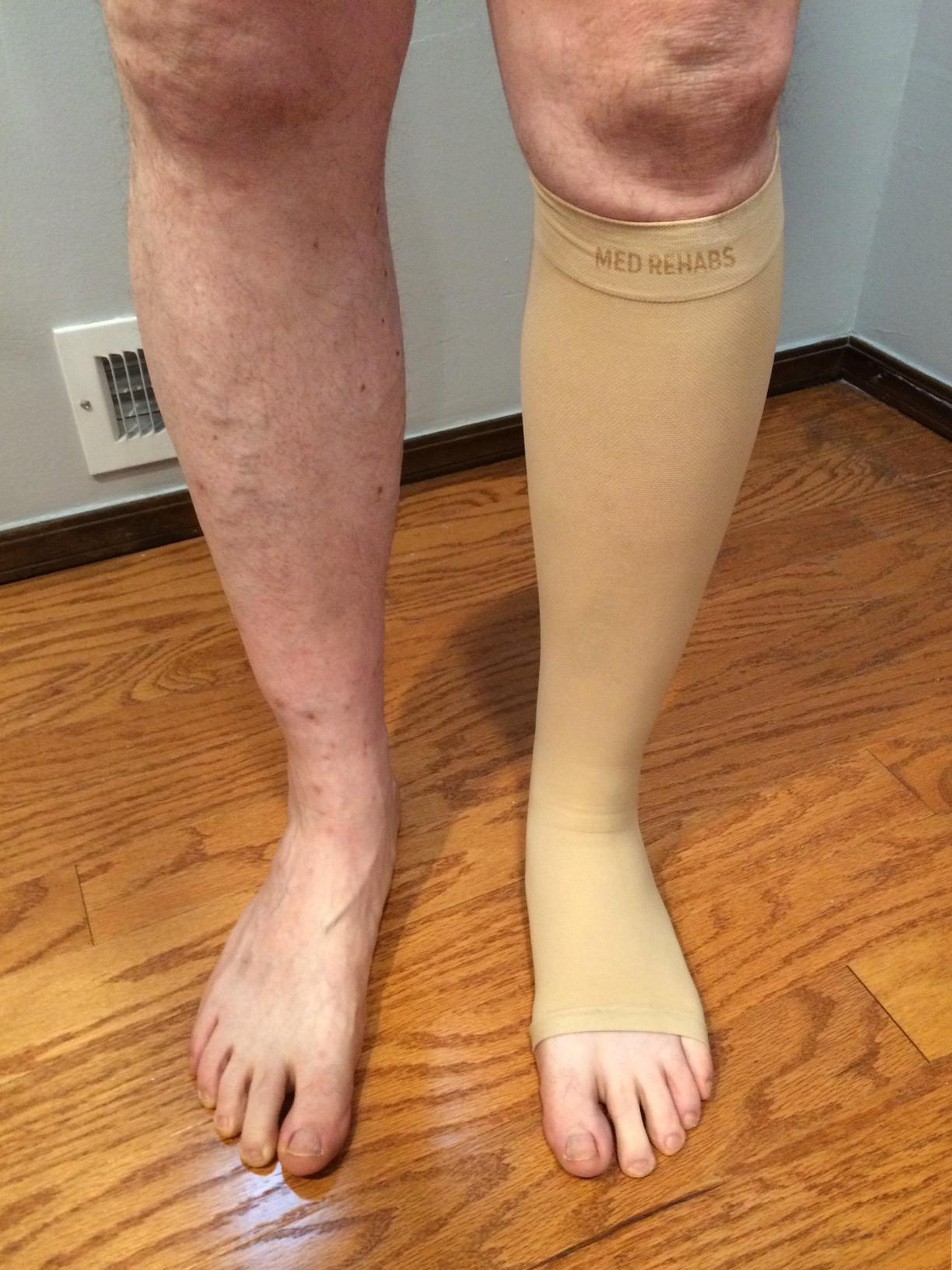 MED REHABS Performance 20-30 mmHg Medical Compression Socks for Women and Men Knee High Open Toe Stockings Varicose Vein Swollen legs(S, Beige)